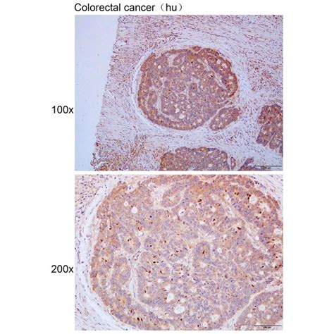 Solarbio K P Anti Gpn Polyclonal Antibody