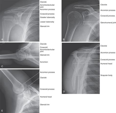 Glenohumeral Joint Imaging Clinical Tree