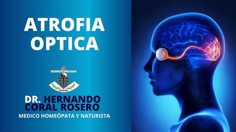 Atrofia Optica Youtube