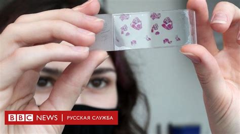 Ученые: иммунитет к коронавирусу у переболевших Covid-19 может быть ...