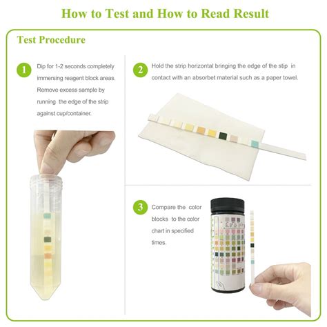 Areta Urine Dipstick Parameter Sg Urinalysis Reagent Test