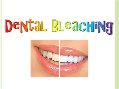 Dental Bleaching