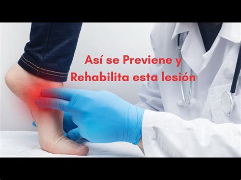 Fascitis plantar y Tendinitis tibial posterior Causas síntomas y