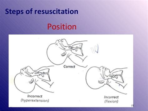 Resuscitation Enc 3