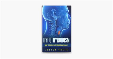 ‎how To Treat Hypothyroidism Naturally By Julien Crets Sr On Apple Books