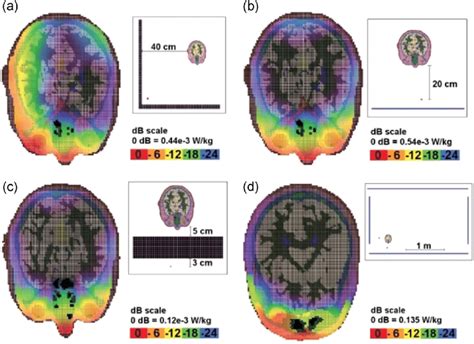 Induced Specific Absorption Rate SAR Can Vary Based On A Person S