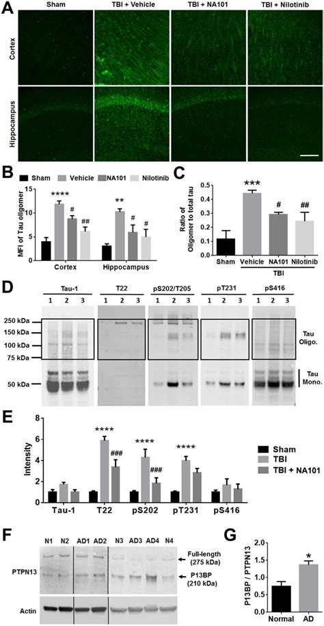 Phospho Tau Ser202 Thr205 Antibody Monoclonal At8