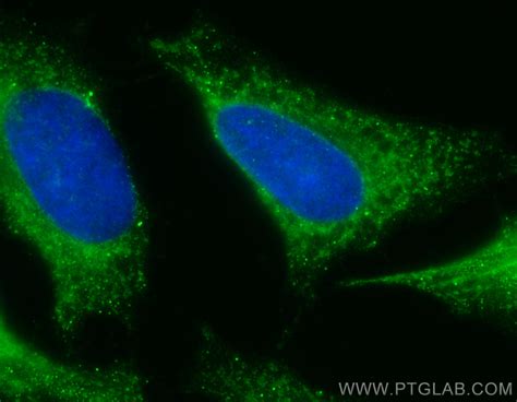 Fh Antibody Cl488 11375 Proteintech