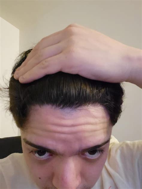 Barber Said I Have Signs Of A Receding Hairline Just Wanted Input From Reddit Thank You R