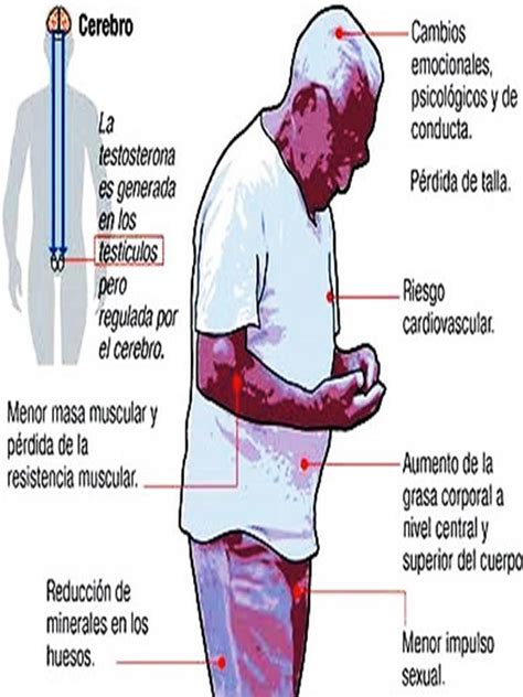 Concepto Vih Sida E Its Ac Baja De Testosterona Provoca Enfermedades Cardiovasculares Y