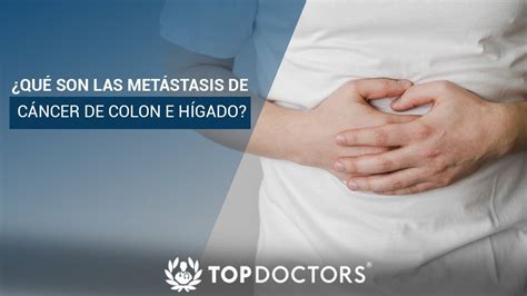 Qué son las Metástasis de Cáncer de Colon e Hígado YouTube