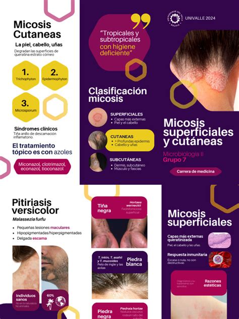 Micosis Superficiales Y Cutáneas Triptico Pdf Piel Sistema Tegumentario