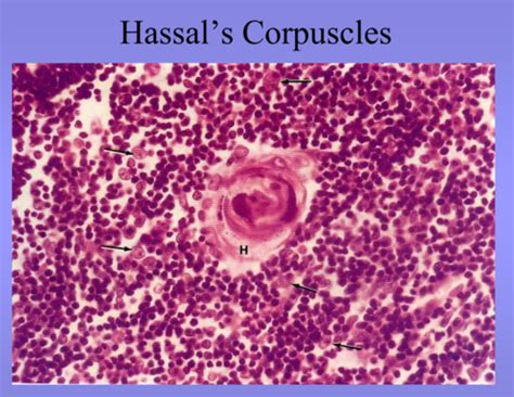 Lymphoid System Histology Flashcards Quizlet