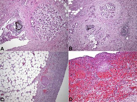 A And B Photomicrography Of The Pancreas Showing Substantial