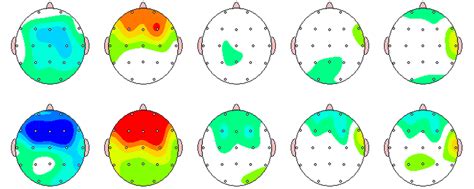 Understanding qEEG Brain Mapping | Center for Attention Deficit and ...