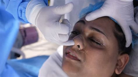 A Woman Going Into Anesthesia Sedation For Nose And Jaw Surgery Youtube