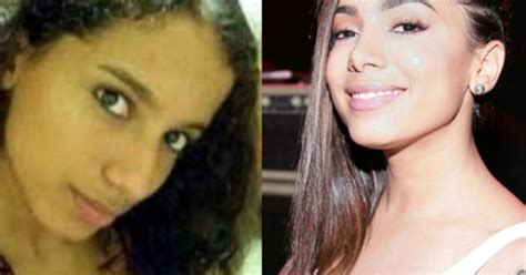 Aprender Sobre Imagem Fotos Antes E Depois De Anitta Br