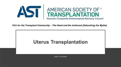 Vca For The Transplant Community Debunking The Myths Uterus Transplantation Youtube