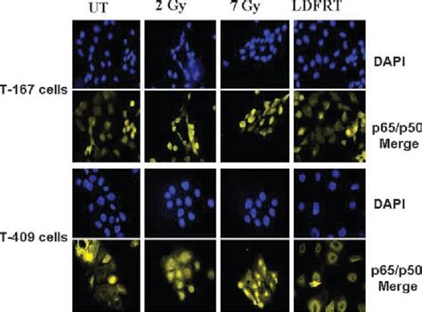 Figure From Lack Of P Glycoprotein Expression By Low Dose