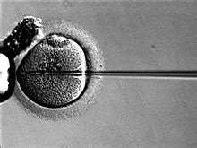 Oocyte cryopreservation - Wikipedia