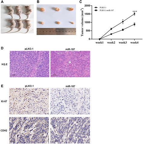 HBx Promotes Hepatocellular Carcinoma Progression By Repressing The