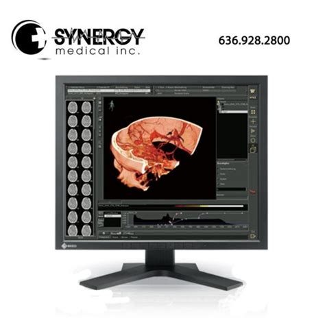 Eizo RadiForce RX440 BK 30 4MP Color Diagnostic Monitor Synergy