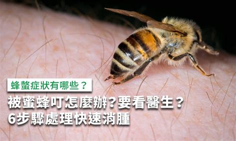 被蜜蜂叮怎麼辦蜂螫症狀有哪些6步驟處理快速消腫 康健雜誌