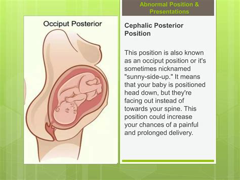 Leopold’s Maneuver | PPT