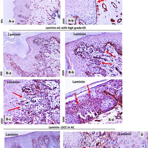 Laminin Immunohistochemical Ihc Staining Of The Basement Membrane