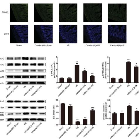 Catalpol Inhibited Oxidative Stress And Inflammation In Rat Intestinal