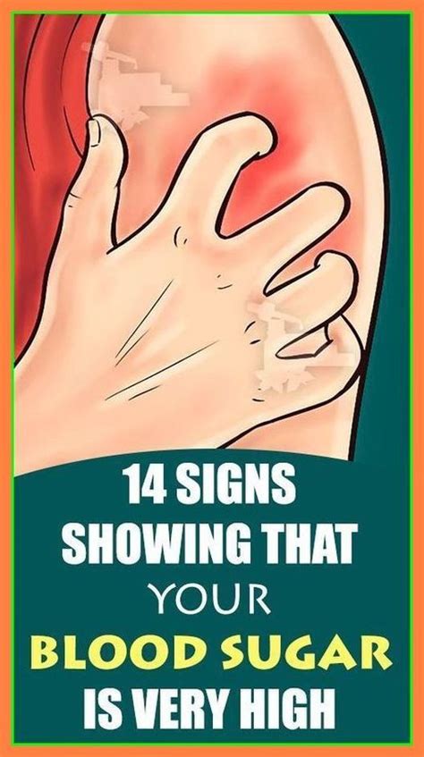 Here Are 7 Warning Signs You Have Blocked Arteries Artofit