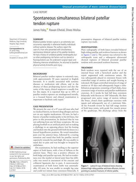 Pdf Spontaneous Simultaneous Bilateral Patellar Tendon Rupture