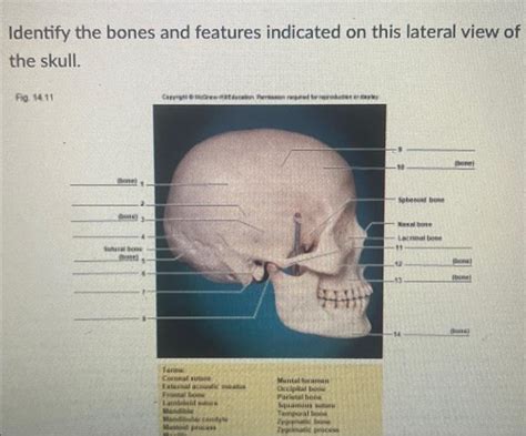 Solved Identify The Bones And Features Indicated On This Chegg