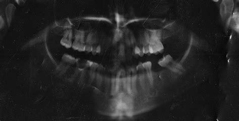 X Ray Textures On Behance