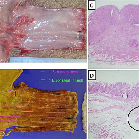 The Gross Appearances Of The Resected Surgical Specimen Show The