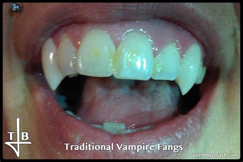 Traditional Vampire Teeth By Dnash