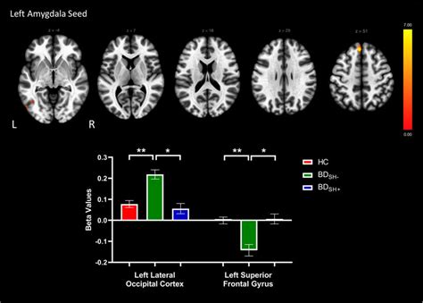 Voxels Showing Significant Connectivity With The Left Amygdala Seed Download Scientific