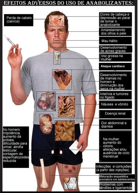 Esteroides Anabolizantes For A E Beleza Enganosas Anabolizantes
