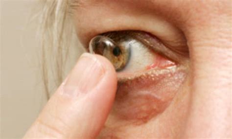 Contact Lens Which Releases Drugs Into The Eye Could Halt Glaucoma