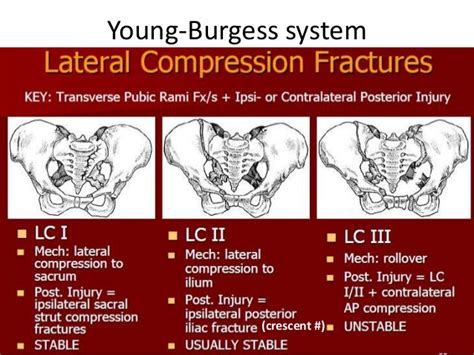 Pelvic Fractures