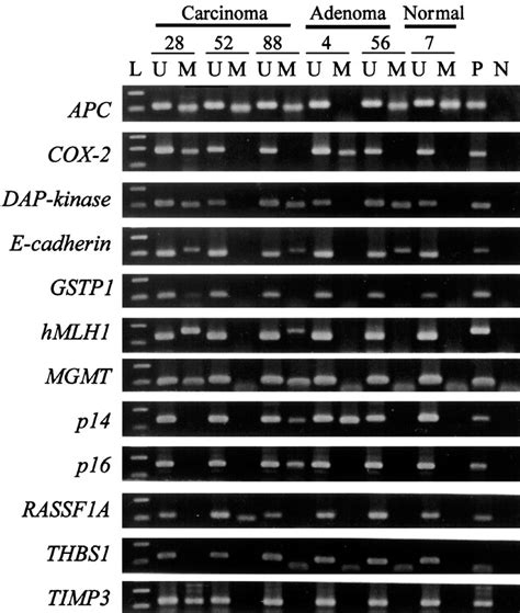 Aberrant Cpg Island Hypermethylation Of Multiple Genes In Colorectal