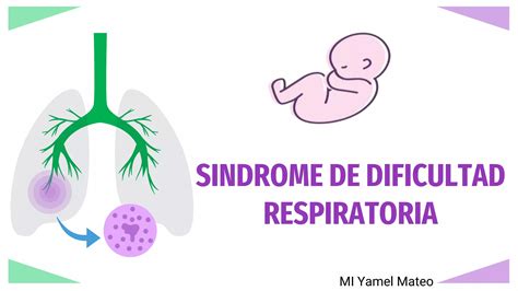 Sindrome De Dificultad Respiratoria Tipo I PPT