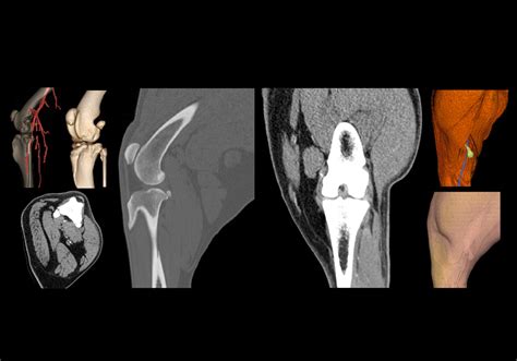 Stifle joint anatomy of the dog - normal anatomy | vet-Anatomy