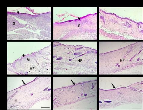 Gambar 3 Perubahan Histologis Terjadi Selama Proses Penyembuhan Luka