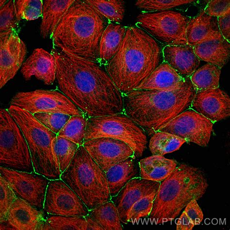 Occludin Antibody Rr Proteintech