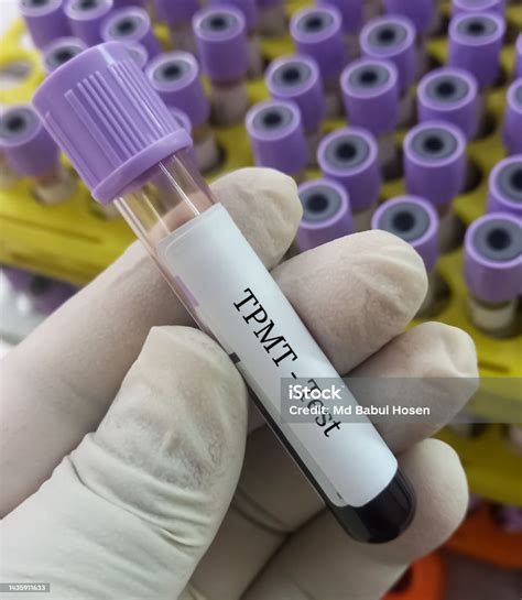 Blood Sample For Thiopurine Methyltransferase Test To Thiopurine Drug Treatment Stock Photo ...