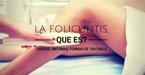 La Foliculitis Que Es Con Imágenes Depilarte Depilar Consejos