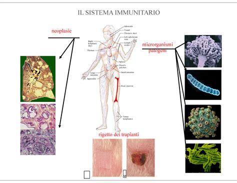 I Trapianti Dorgano Rigetto Dei Trapianti Neoplasie Microrganismi