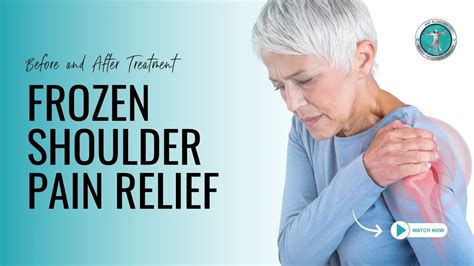 Frozen Shoulder Before And After Anf Therapy® Youtube