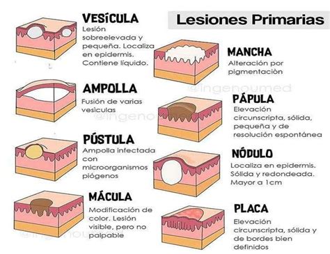 Tema Lesiones Primarias Y Secundarias De La Piel Tema Lesiones Hot